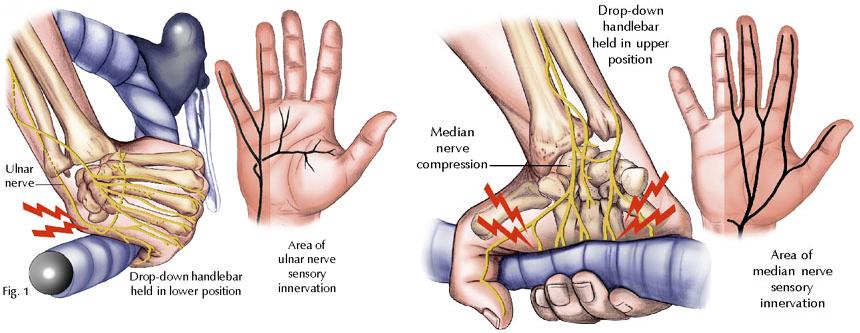 Numb hands cheap on road bike